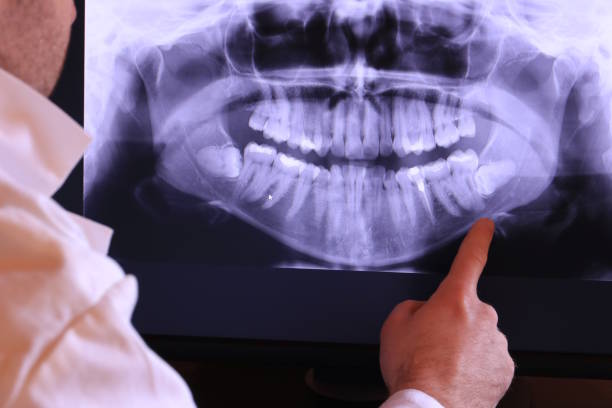 Best Emergency Broken Tooth Repair in Florence, AZ